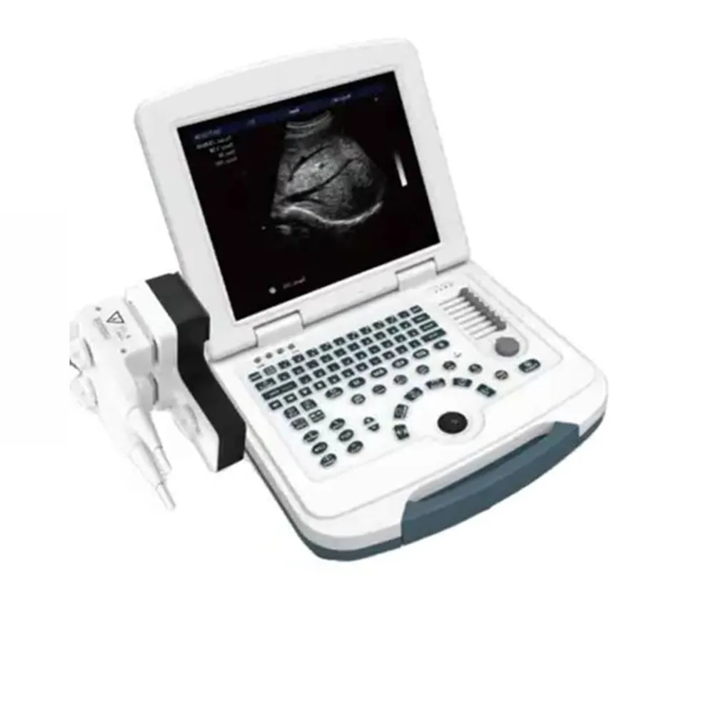 China manufacturer multifunctional wireless probes ultrasound scanner mindray ultrasound machine