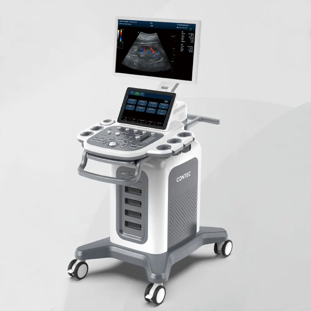 CONTEC CMS1900A echocardiography ultrasound color doppler 3D 4D medical scanner ultrasonic hospital equipment