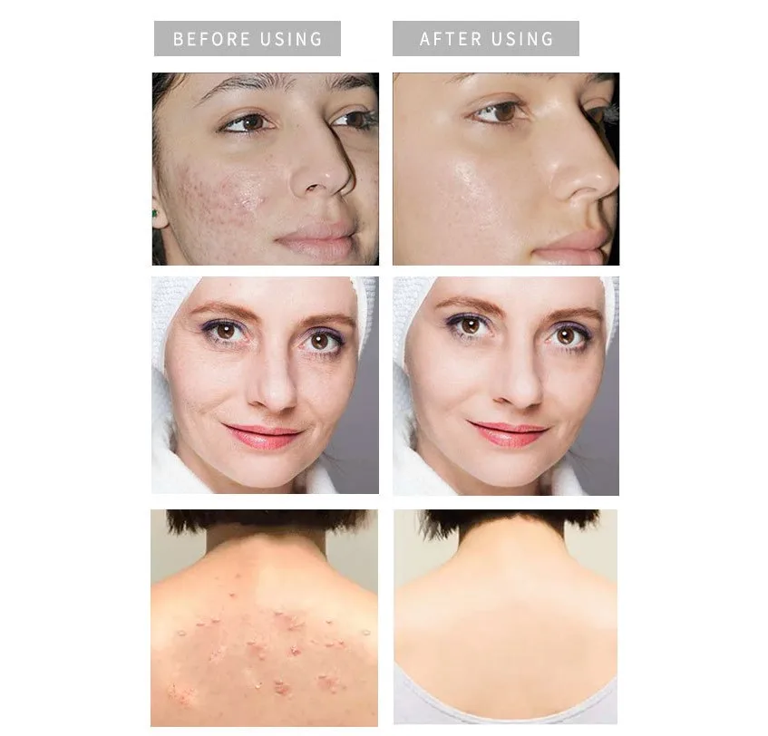 Manufacturer Private Label Natural Organic Bar Handmade Tumeric soap