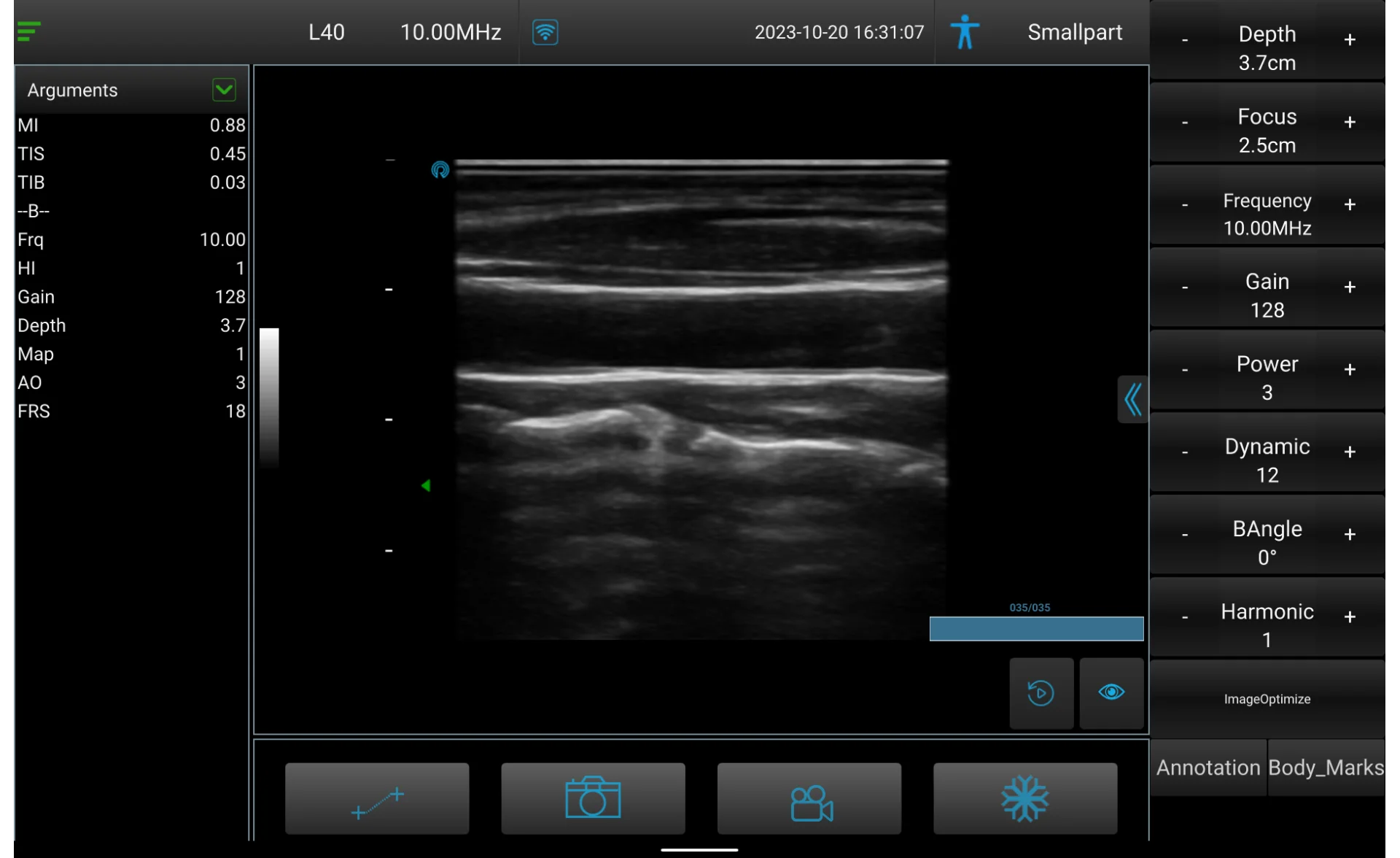 High Definition Laptop Hot-selling Ultrasound Portable Color Doppler System With Portability for