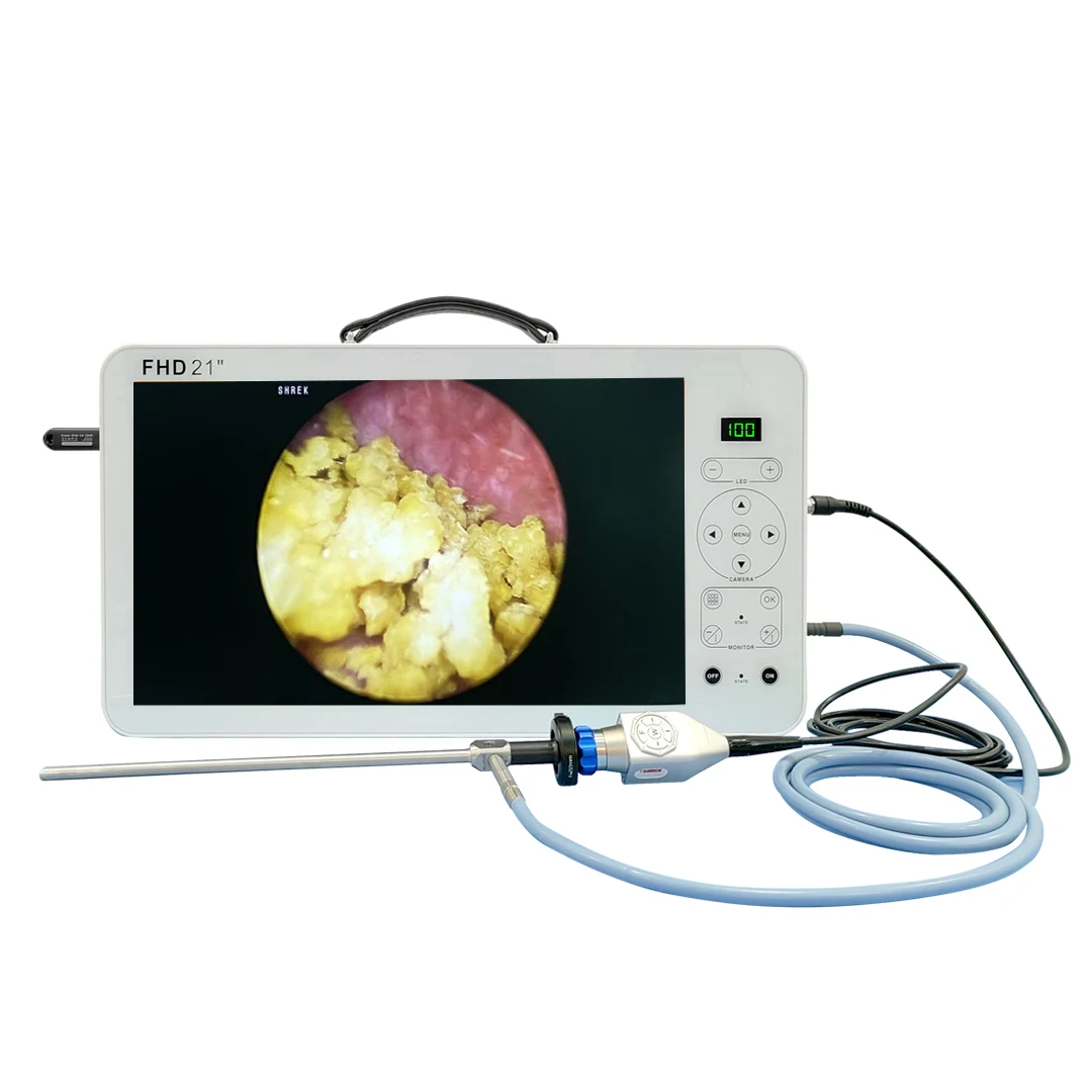 medical full hd 21 inch video cystoscope endoscope camera equipment