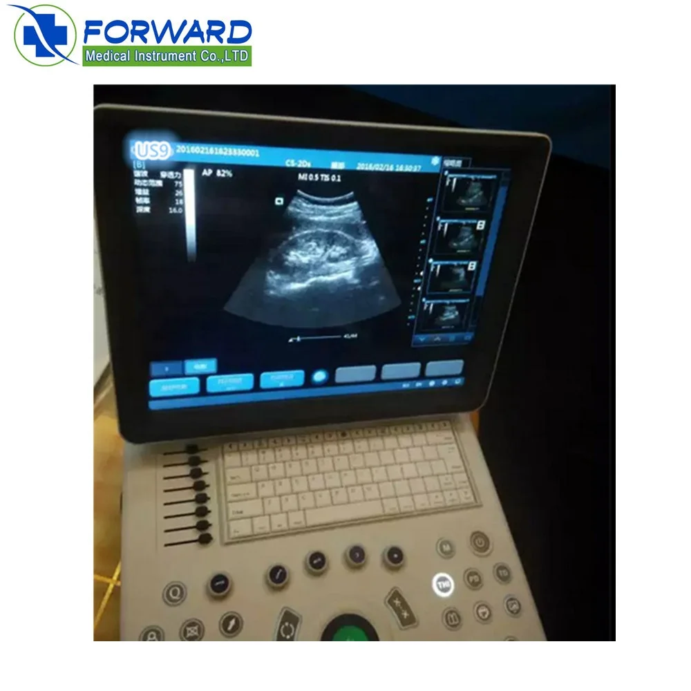 3D baby scan ultrasound machine portable With Good After-sale Service