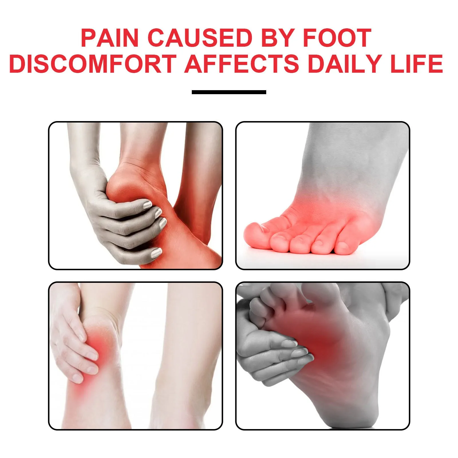 EELHOE High Quality Vegan Ingredients Infection Care Aching Bunion Relief Toe Pain Stiffness Bunion Cream