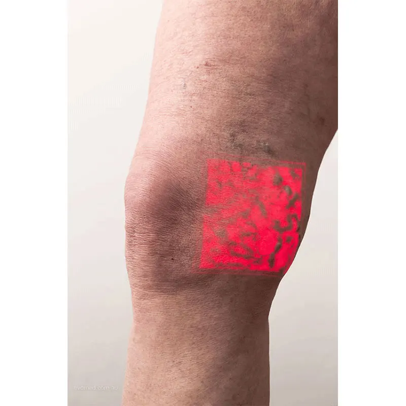 
Professional Accu vein AV300 Vein Finder Transilluminator 