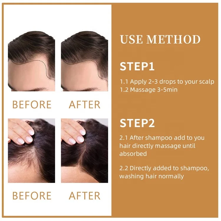 Private Label Ginseng Black Sesame Oil Regrowth Bald Hair Growth Oil Serum For Hair Loss Scalp Treatment