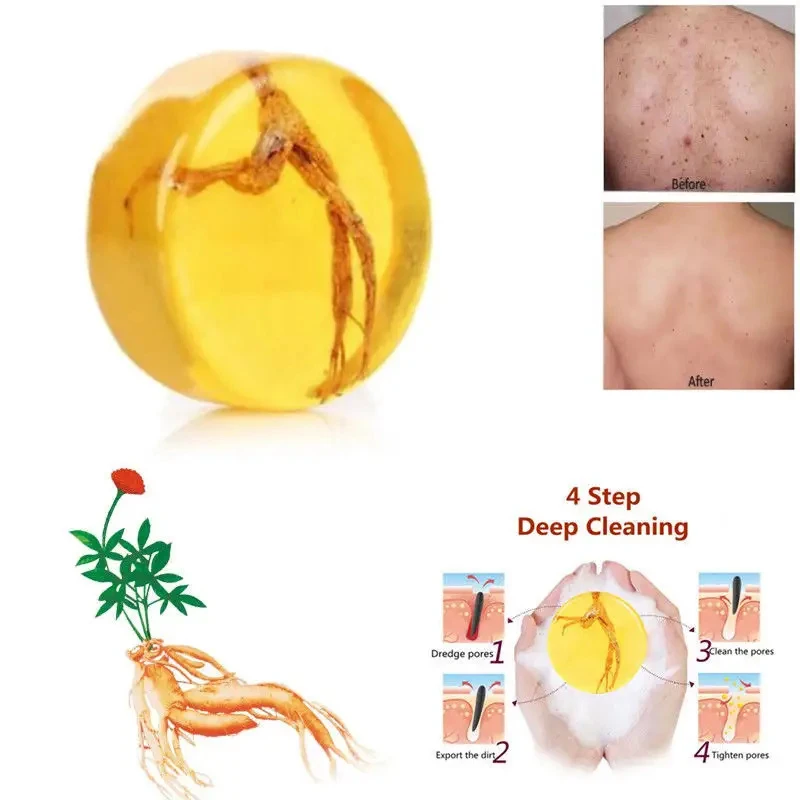 BSHIPRO Matrine Soap Natural Organic Basic Skin Cleansing Antibacterial Brightening Moisturizing White Herbal Handmade soap