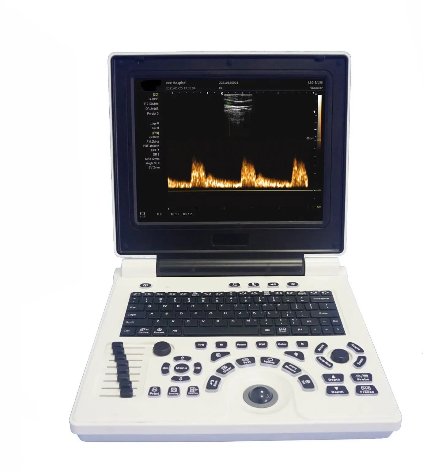 Cheap 3D Portable USG & Ultrasound Linear