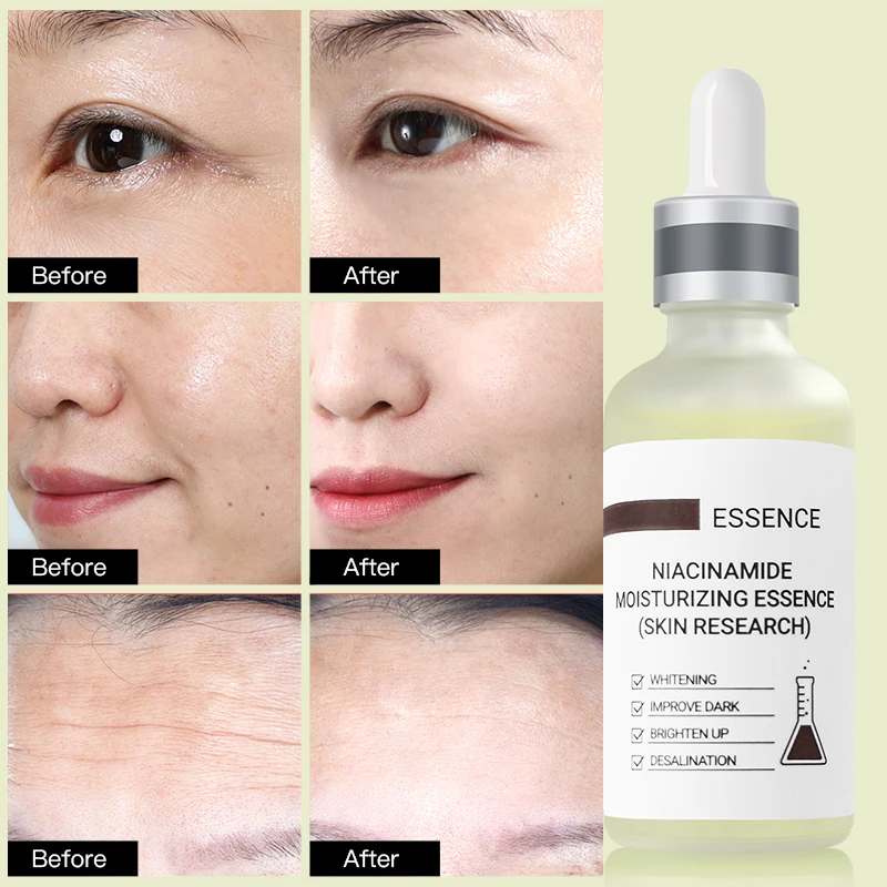 Essence Serum Niacinamide Serum Face Vibrant Glamour Hyaluronic Acid Facial Moisturizer Female Anti aging Serum