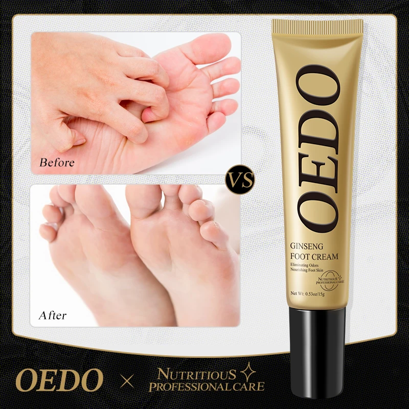 Herbal Nail Treatment Cream Anti-fungal  Dressing Ointment Onychomycosis Paronychia Nail Infection Nail Fungus Treatment