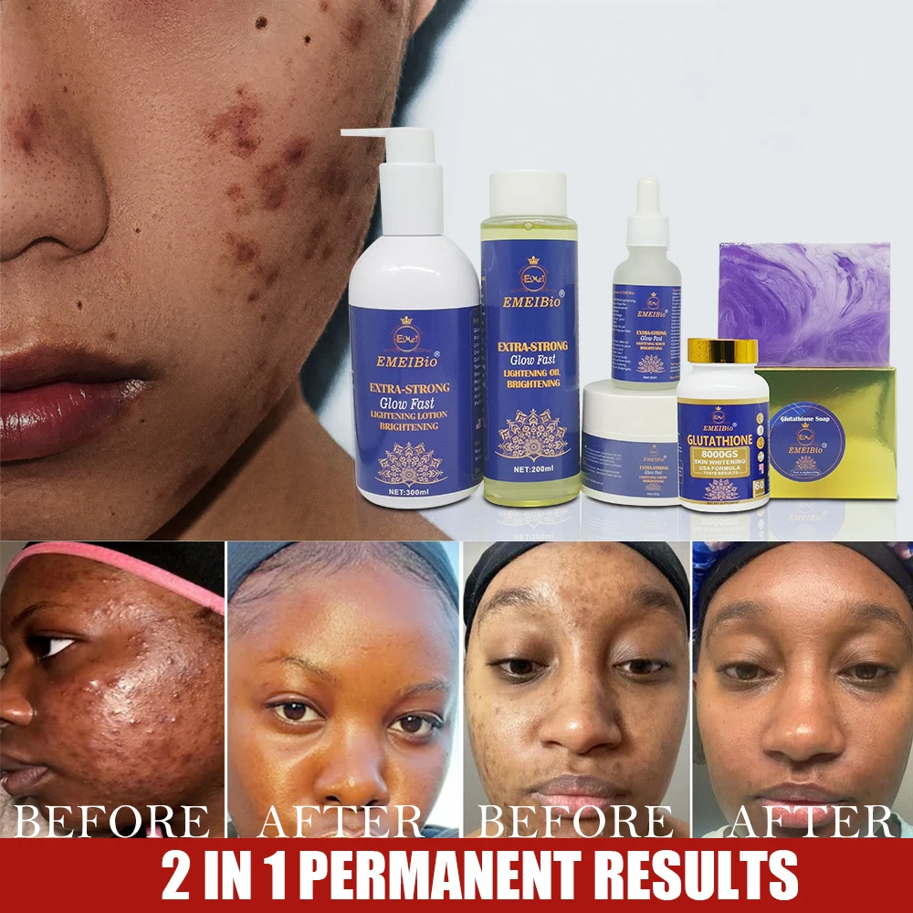 Private brand 7 Day Glutamine Whitening Set Collagen Protein Removal Pigment Settlement whitening skin care set
