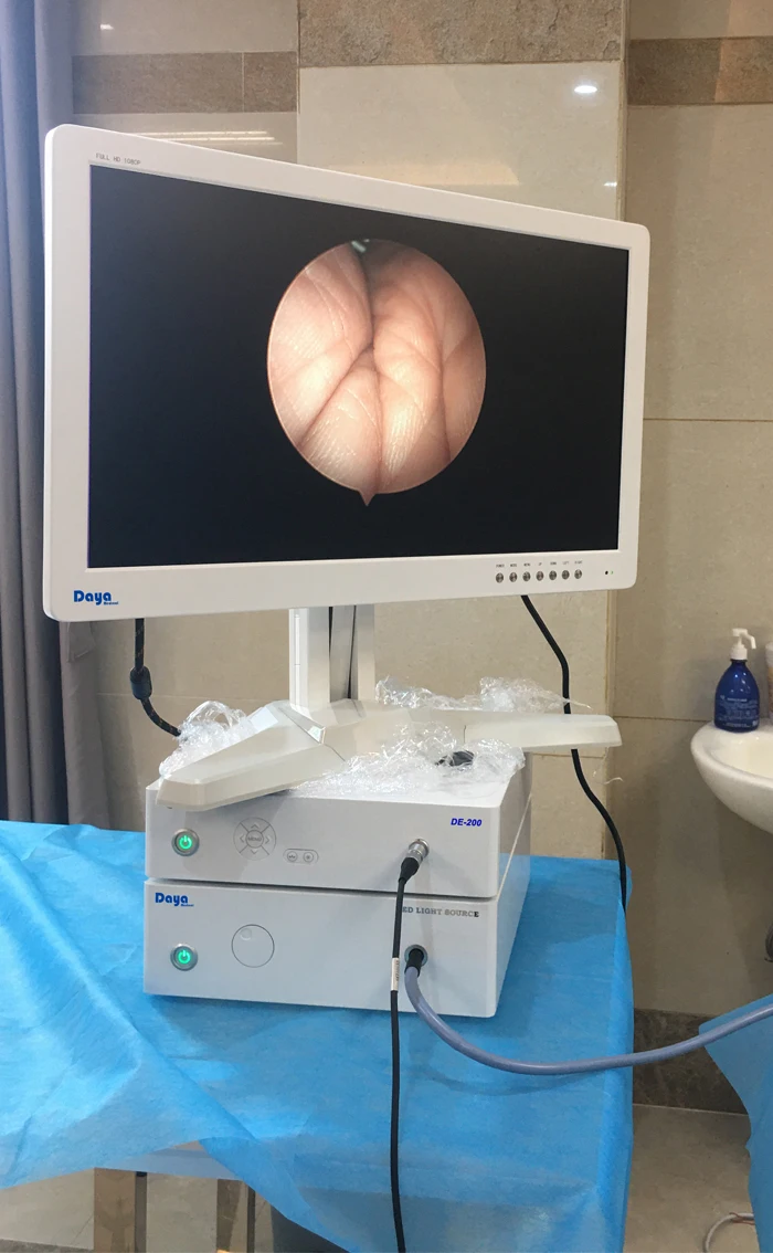 Endoscop HD Camera Medical with Neuro Endoscope and Surgical Endoscopy Instruments