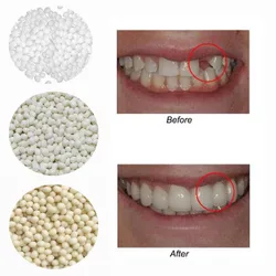 3Colors temporary Dental Oral False Fake Teeth Tooth Filling Repair Smile Snap on Veneers Dentures Case Paste Adhesive Beads