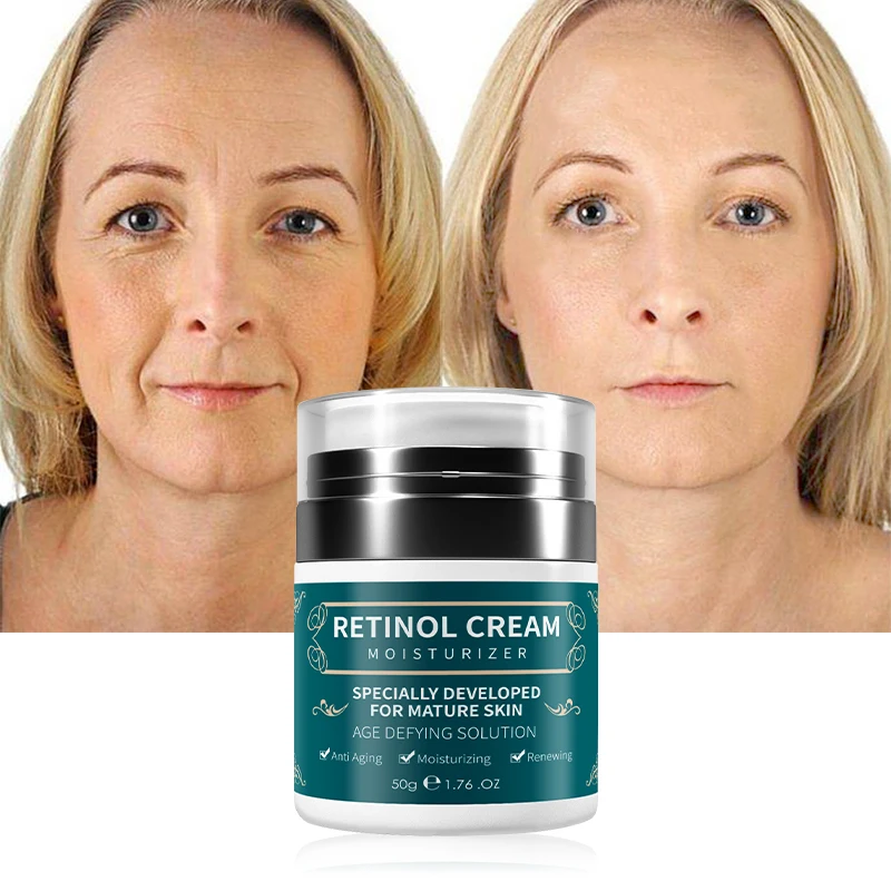 Acne Treatment Soothing After Sun Repair Herbal Skin Care Cream Wholesale Moisturizing Aloe Vera Face Cream