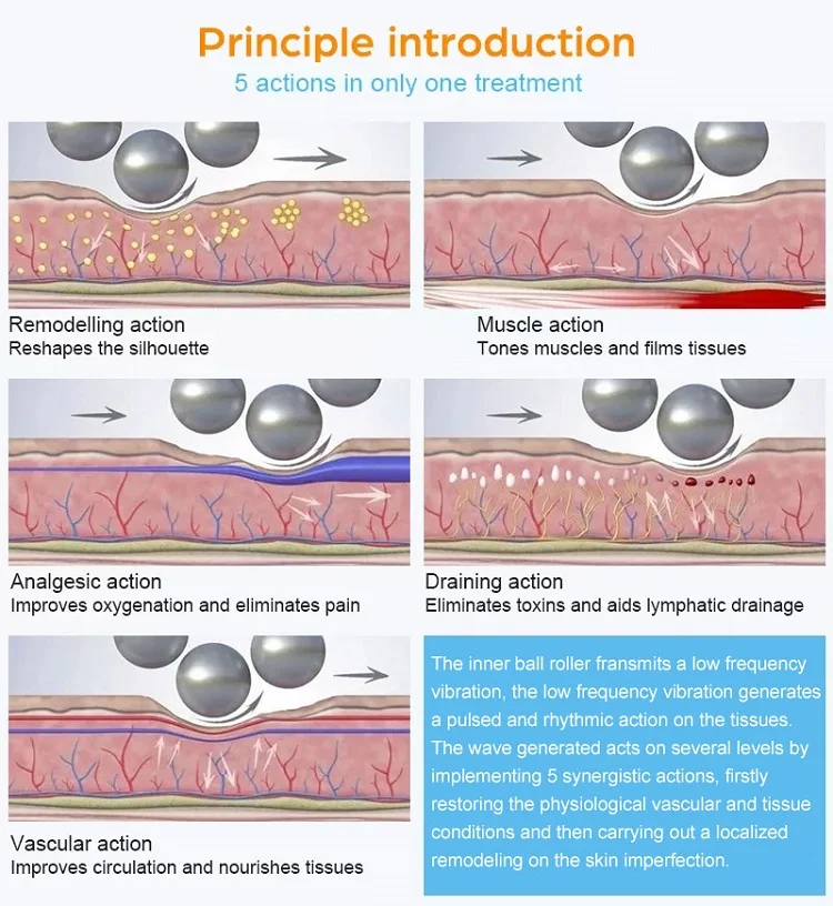 cellulite reduction machine