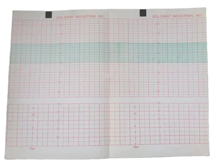 Factory Supply Fetal Monitor Paper 152*90mm 150 Sheet z Fold Hospital Medical Recording Paper