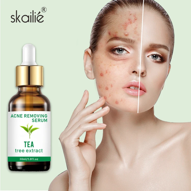 Private Label Custom Tea Tree Salicylic Acid Remove Acne Repair Face Serum Soothing Skin Care Acne Treatment Serum