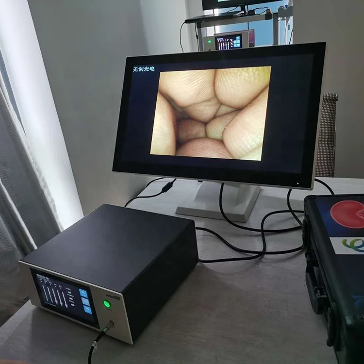 Гибкий уретероскоп и нефроскоп для нефропатической хирургии