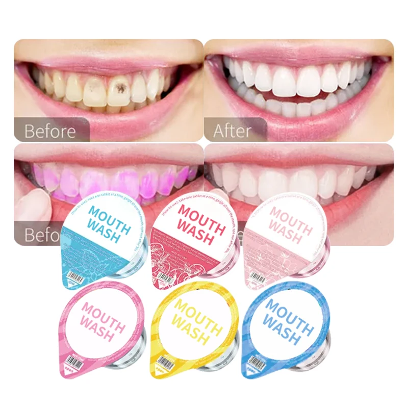 Private Label Organic Natural Dental Care Bad Breath Treatment Mint Refreshing Mouthwash Deep Cleaning