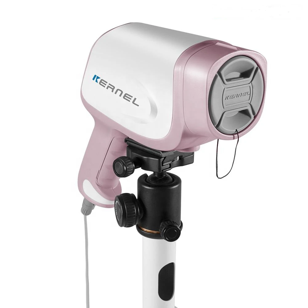 Kernel CCD 3.27 million Pixels Medical Digital Colposcope for Gynecology KN-2200IH