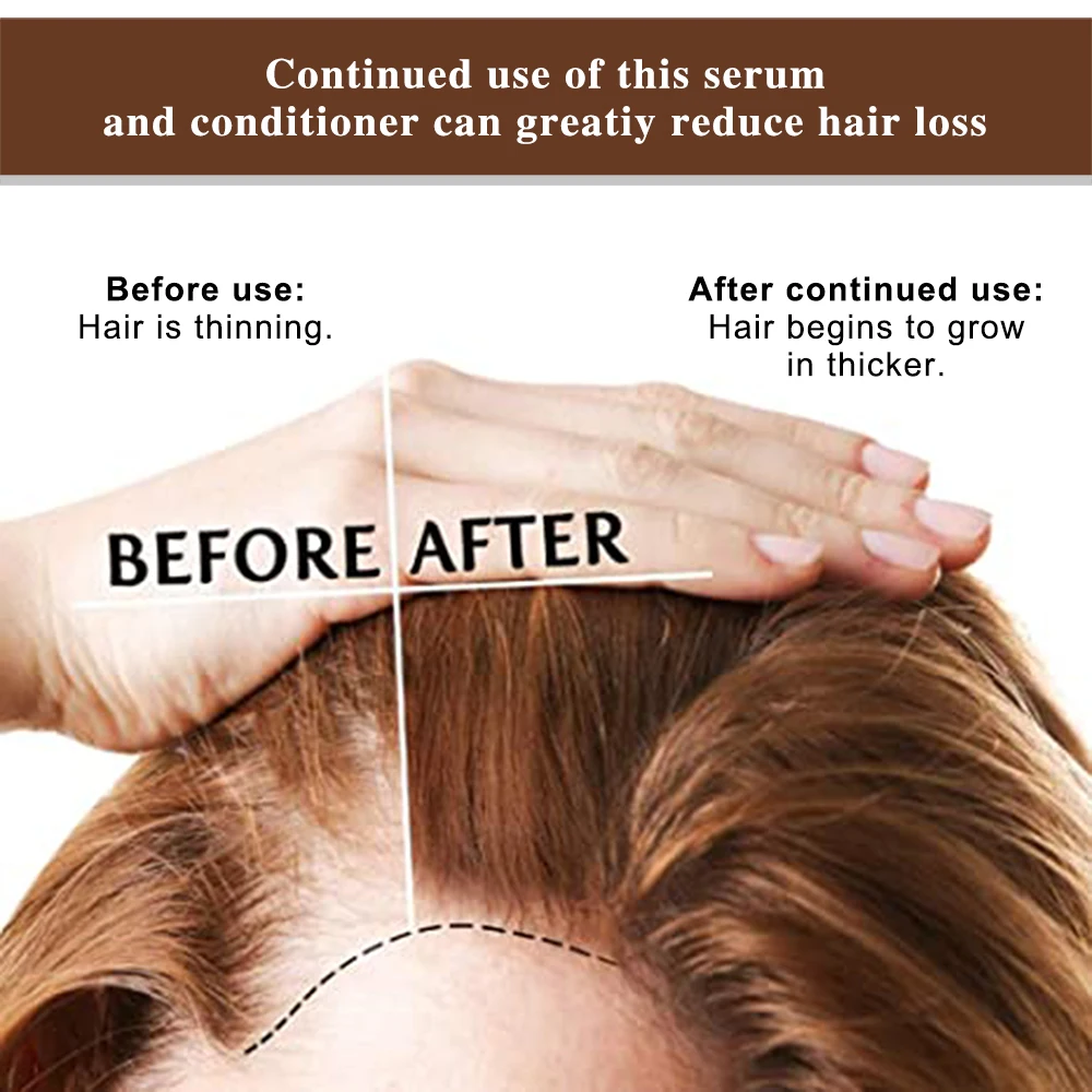 Istennok Powerful Argan Hair Regrowth oil Men Woman Ginger Mint Essential Oil Prevents Hair Loss Hair Growth oil