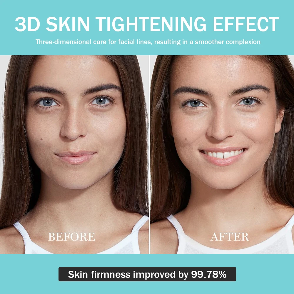 Beauty Facial Treatment Device for Anti-Aging Led Light Therapy Facial Massager Anti Wrinkle Skin Care Facial Led Wand