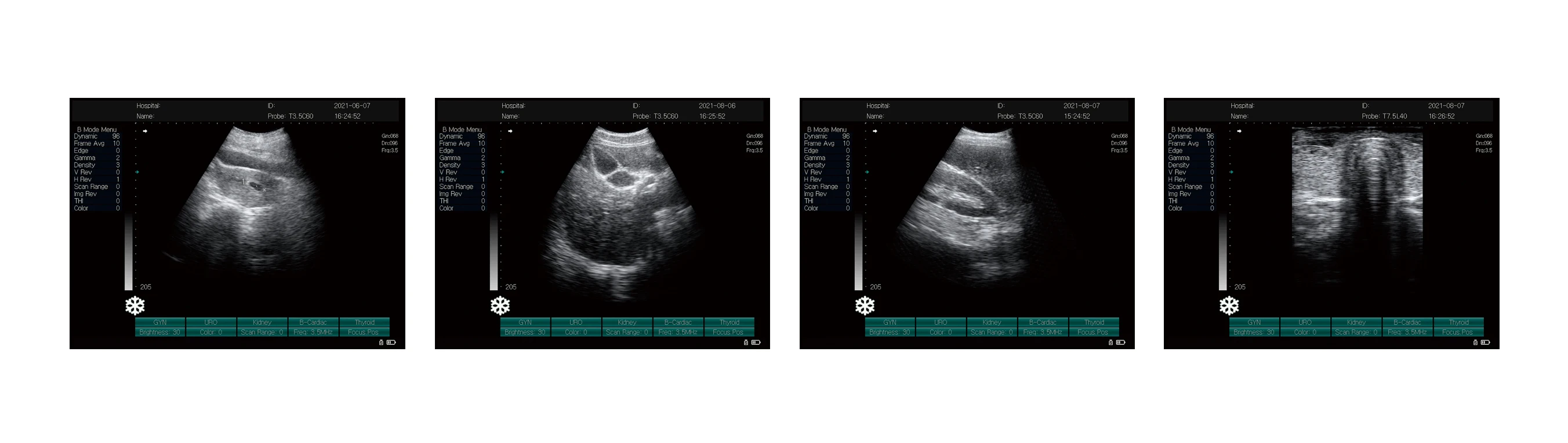 2022 Cheapest Portable  B/2B/4B/M 3D 4D Diagnostic Ultrasound Machine With Probe