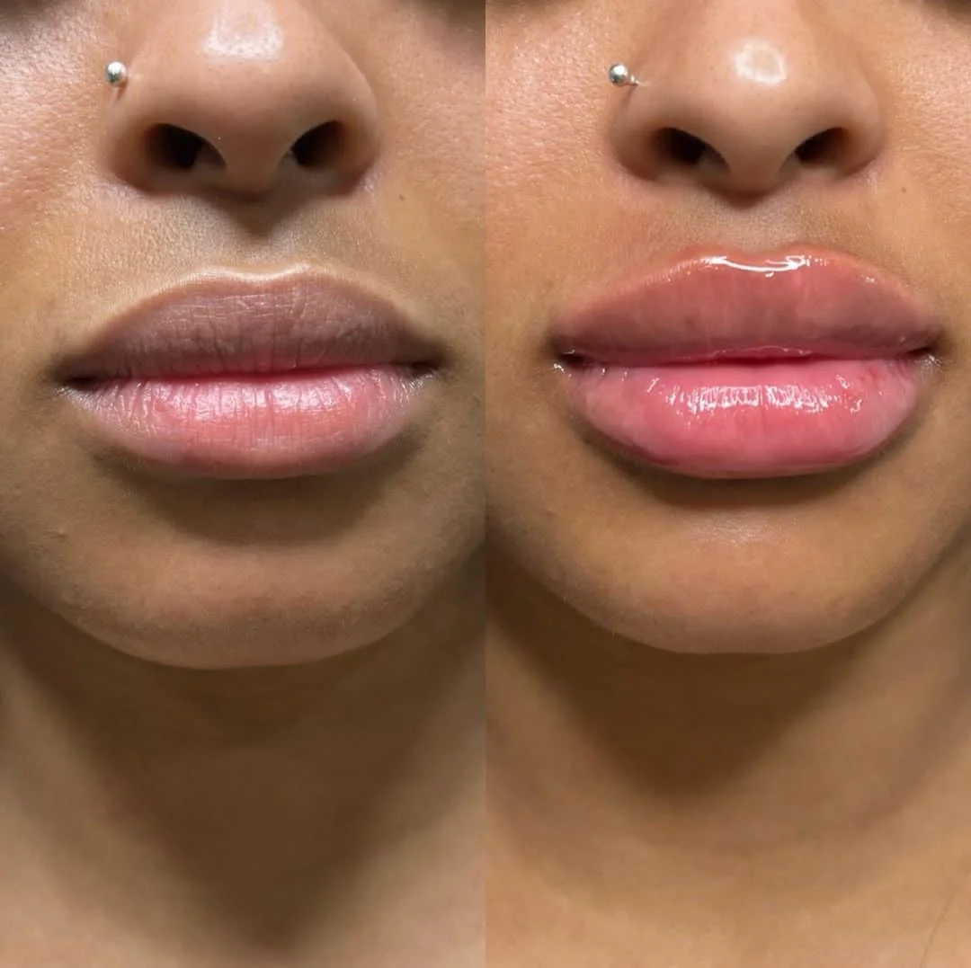 Tantalizing Sexy Lip Spicy Fruit Hyaluronic Acid Syringe Lip Plumper Gloss Private Label