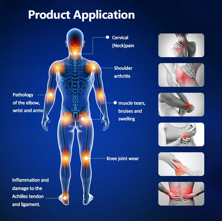 Top Knee Support Magnetic Therapy Magnetotherapy Machine Pain Relief Magnetoterapia En Fisioterapia/2/3 Equipment Massage