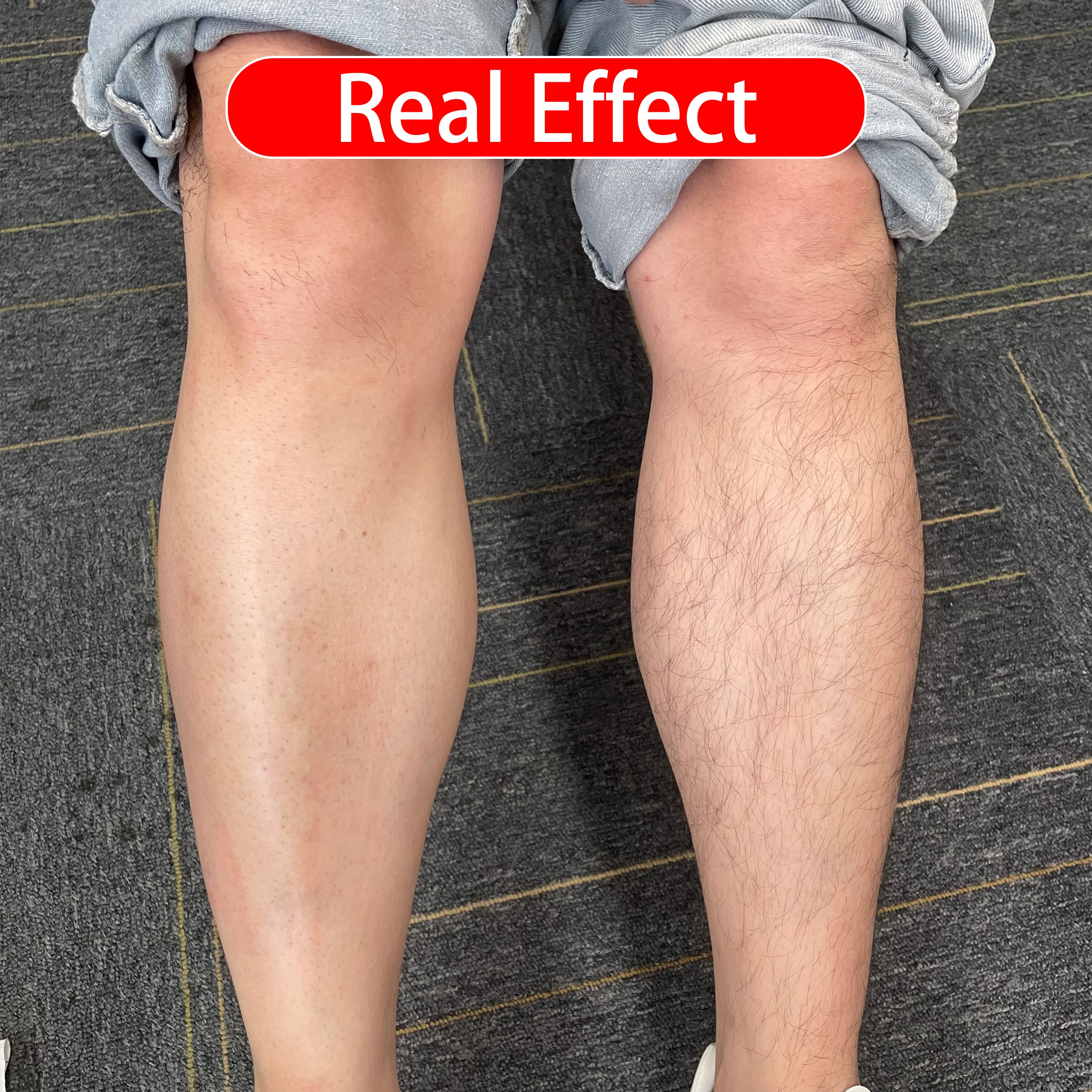 Effective hair growth inhibitor cream spray hair permanent removal cream for men and women