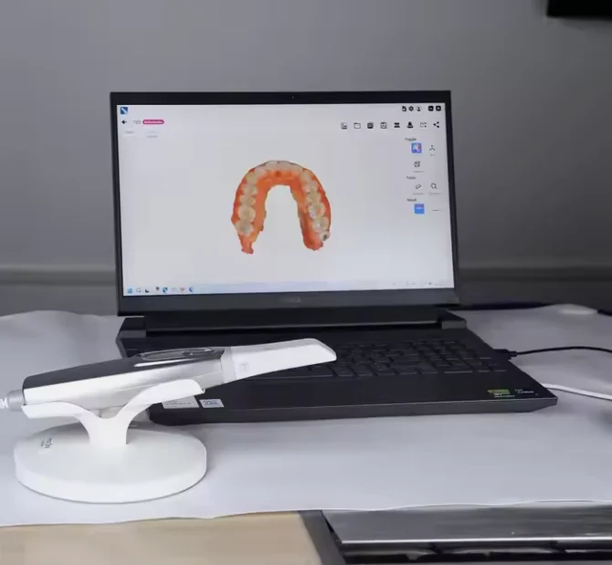 Chenwei High-Resolution Imaging, Fast Scanning, User-Friendly Interface Digital 3D Intraoral Scanner