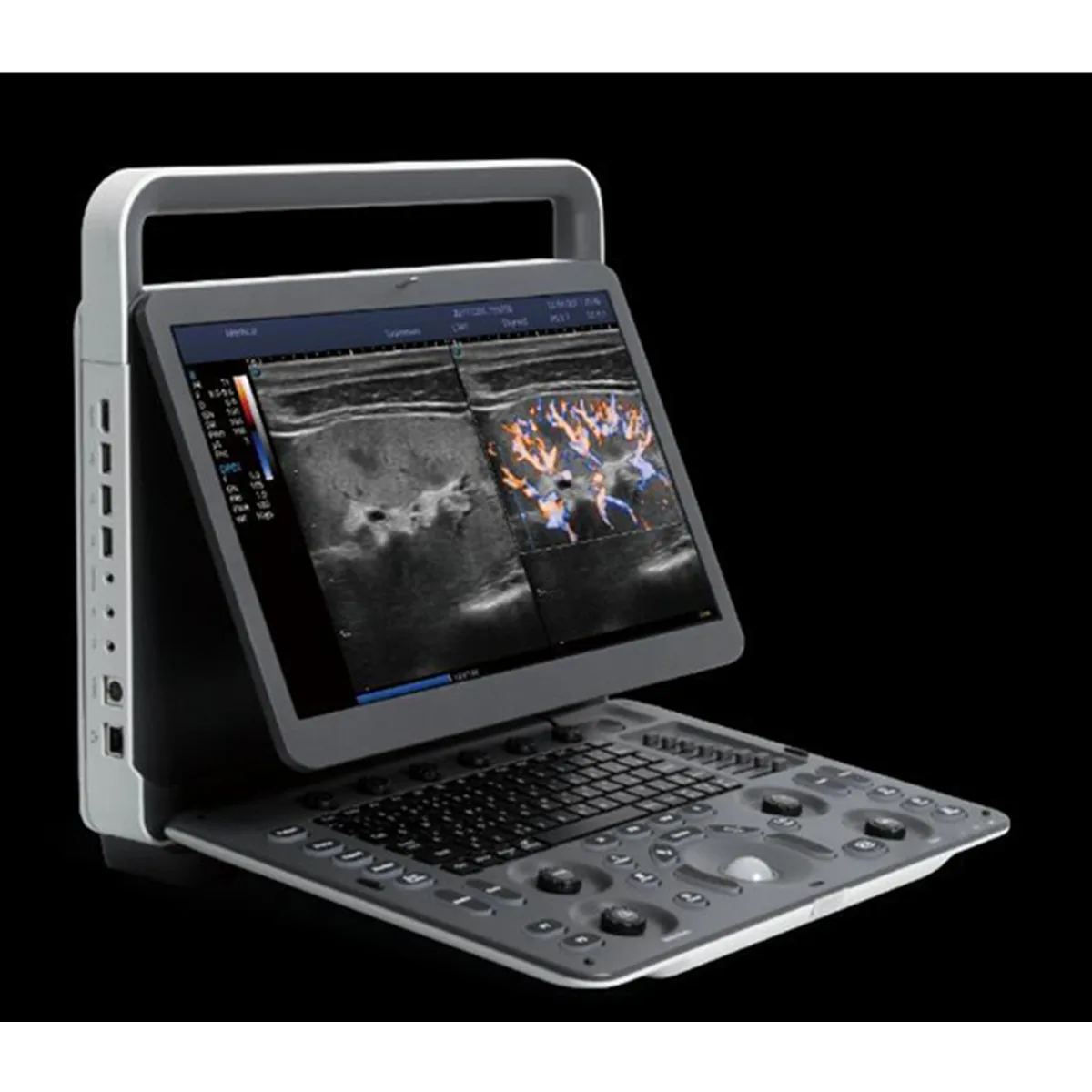 Sonoscape E2 smart ultrasound machine scan color doppler best price