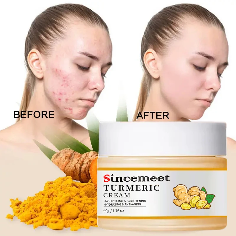 Private Label OEM 100% Natural Organic Whitening Bleaching Moisturizing Anti Aging Wrinkle Acne Removal Turmeric Face Cream