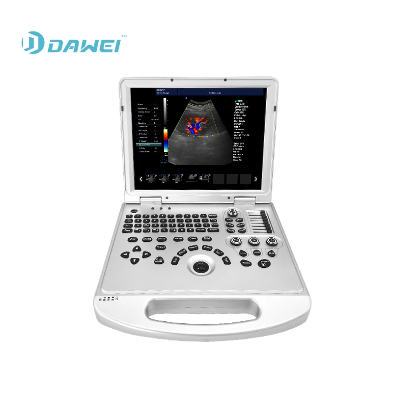 pregnancy baby heart beat sound color doppler