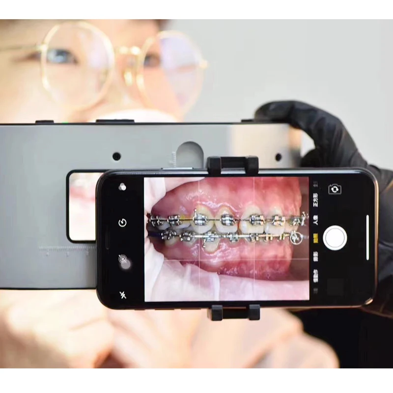 Dental Oral LED Light Mobile Photography Stand