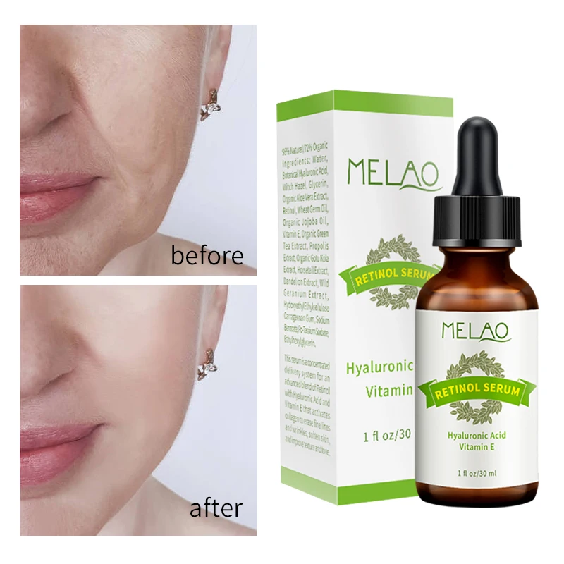 OEM Private Label Organic Anti-Aging Wrinkle Serum Natural Complex Vitamin C Retinol Antioxidant Anti-Inflammatory Properties