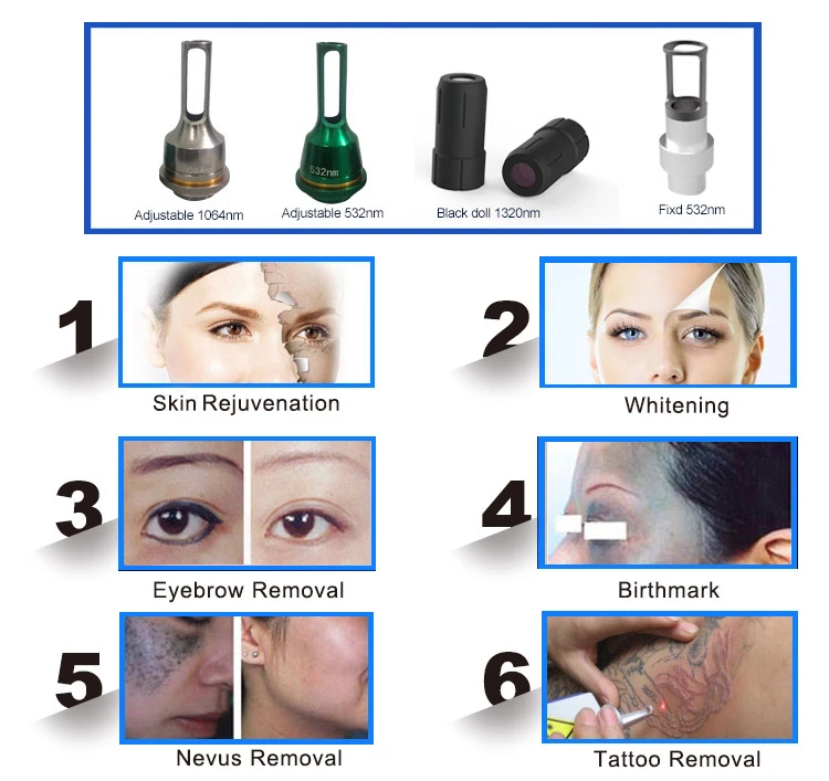 wholesale ipl q switch nd yag laser machine 1064nm pigmentation corrector
