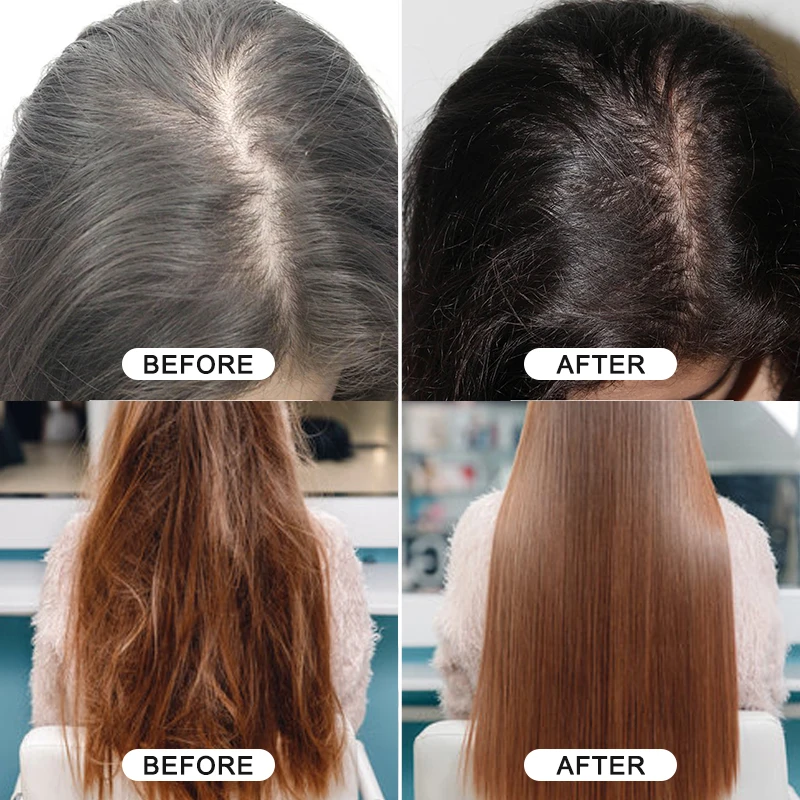 Honduras 100% Natural Organic Promote Hair Growth Serum Keratin Pure Hair Growth Rosemary Batana Oil For Hair Growth