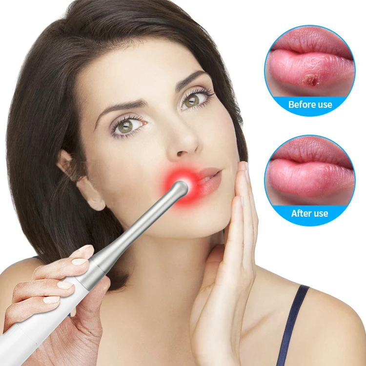 Near Infrared Portable Red Light Therapy Device Pen Mouth Ulcers Treatment Instrument Cold Sore Red Light