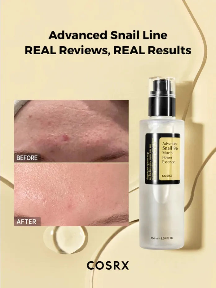 COSRX Advanced Snail 96 Mucin Power Essence- Made in Korea Hydrating Serum 96.3% skin boosting snail secretion filtrate