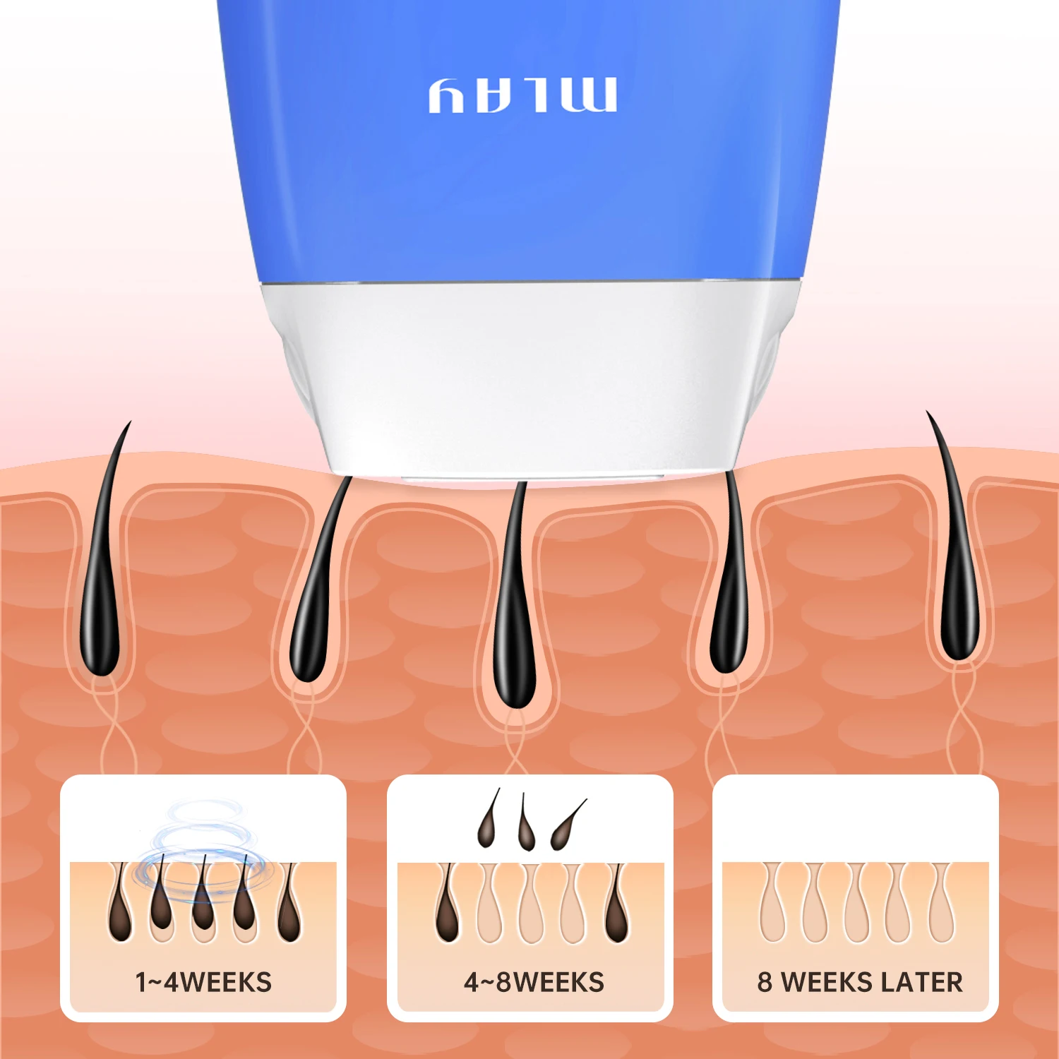 MLAY TOP product T3 laser hair removal instrument can replace the lamp head quartz lamp tube high energy hair removal instrument