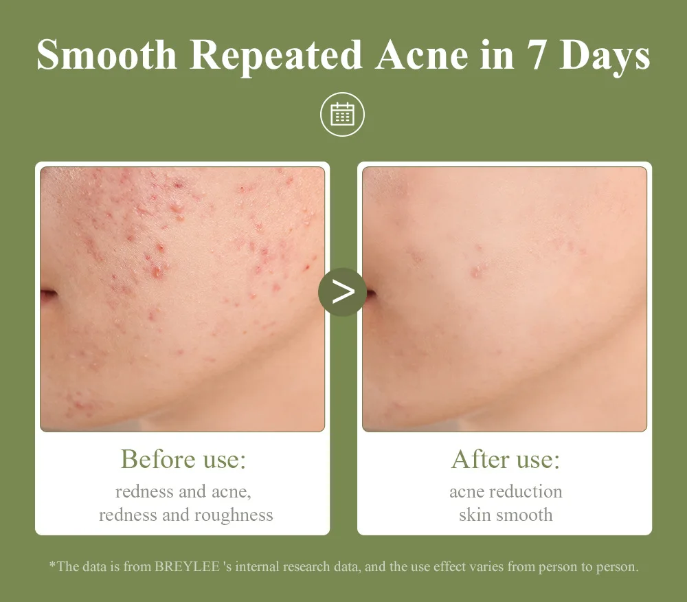 Wholesale Salicylic Acid Oil Control Cotton Sheet Shrink Pores Remove Acne Deep Cleaning Facial Cleansing Pad 40pcs