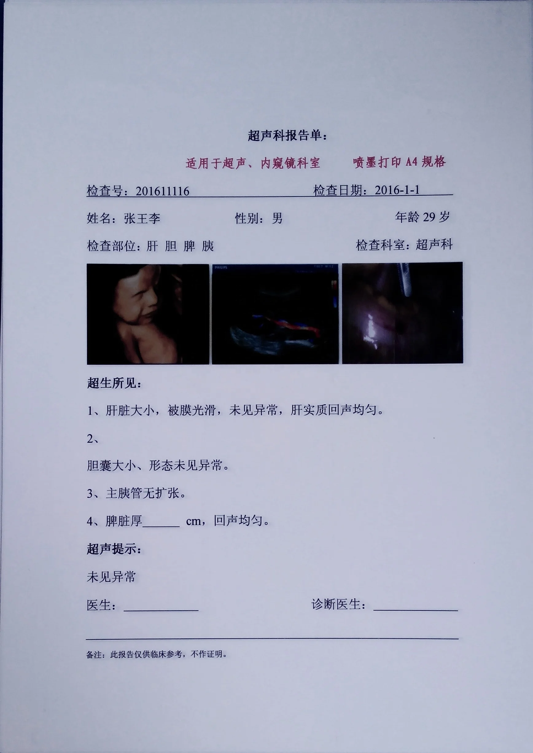 Ultrasound Imaging Output White Medical X-Ray Film Single Side Inkjet Medical Film