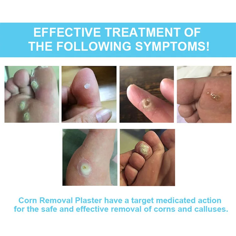 Medicated Action Foot Corn Remover Plaster Removal Pad