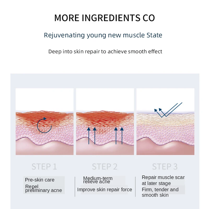 Hot Selling Face Serum Oligopeptide-1 Acne Treatment Serum Anti-Wrinkle Repair Liquid Face Freeze-Dried Powder