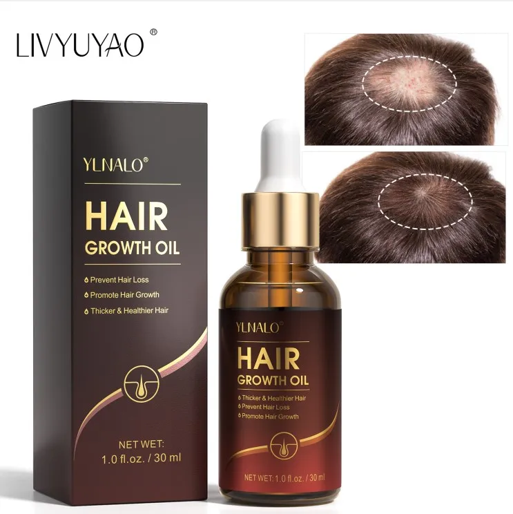 Hot amazon sale Hair Growth Oil Regrowth Stop Hair Loss Biotin hair growth serum