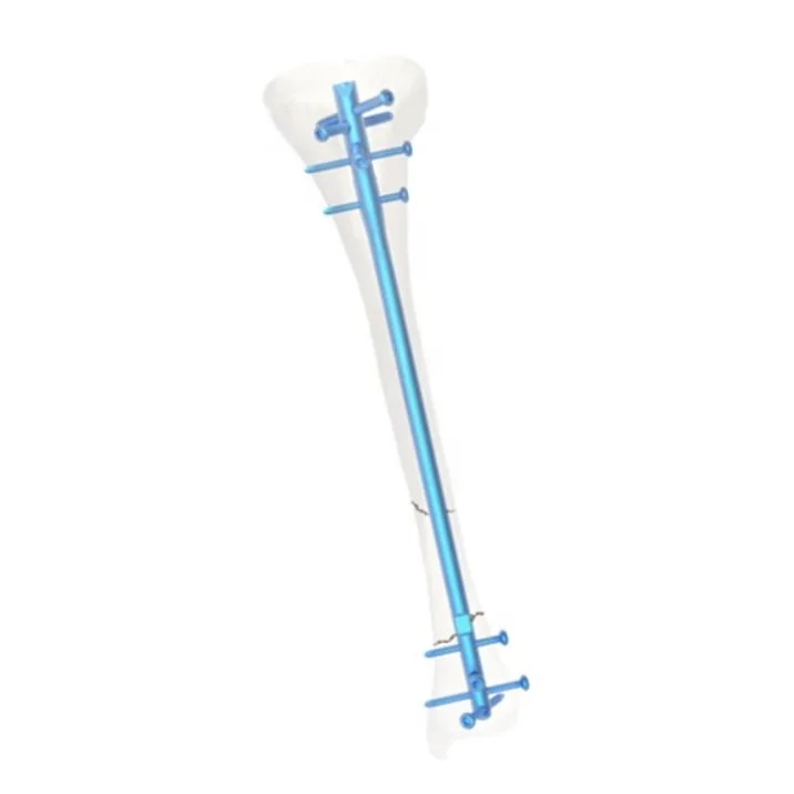 MASTIN Expert tibia Titanium IM intrameduallary nail Ортопедические имплантаты ancillaire tibial clavos ortopedicos