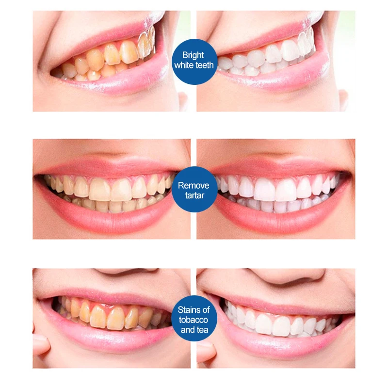 Spring tree teeth cleaning mousse teeth foam white teeth free sample