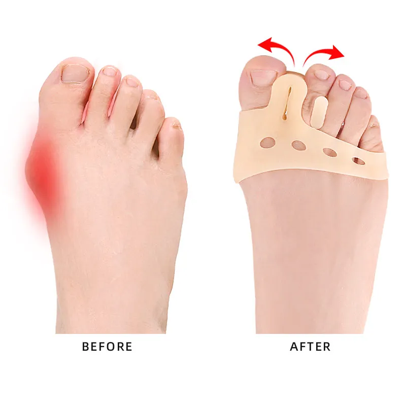 Toe Spacer Bunion Corrector Toe Stretcher Silicone Gel Toe Separator
