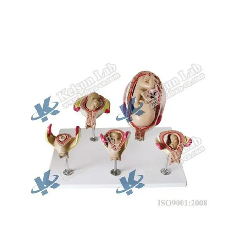 
50114.04B Human embryonic development model , typical 5 stages 