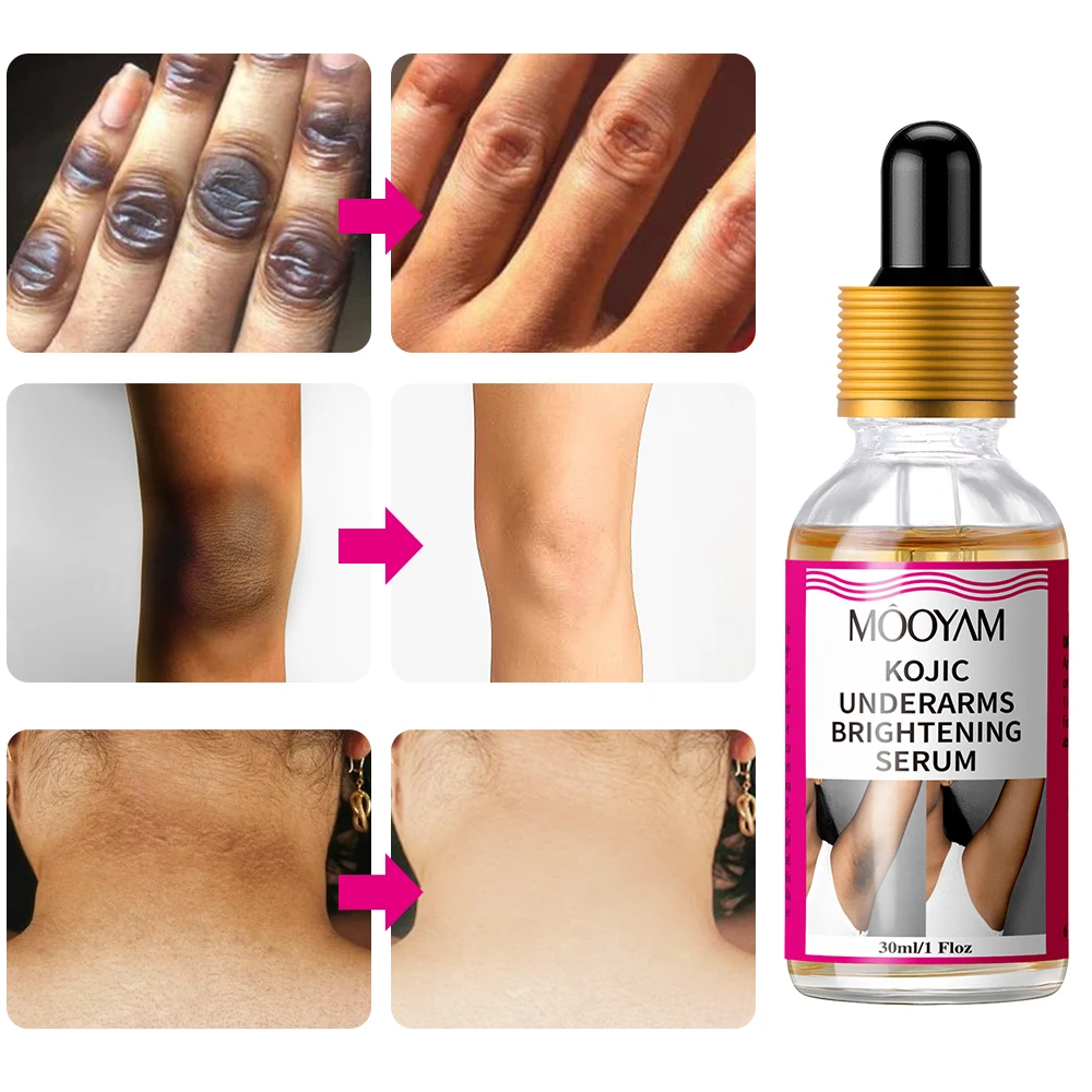 Kojic Underarms Whitening Serum Natural Skin Care Beauty Elbow Knee Sensitive Areas Armpit Brightening Private Part MOOYAM Serum